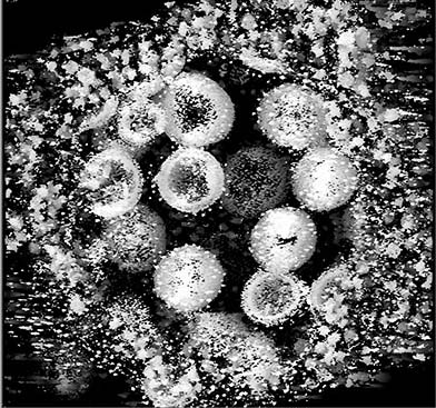 HIV-Electron-micrograph-392